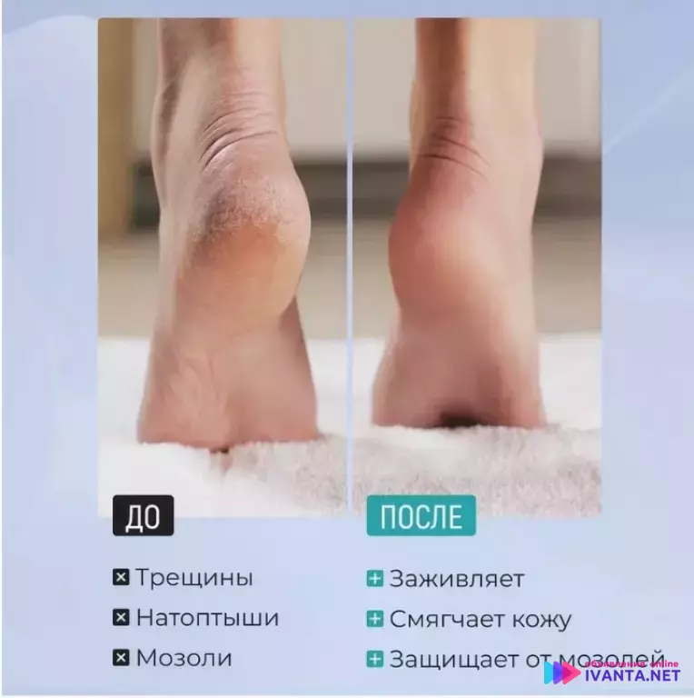 Крем для ног и пяток с мочевиной 20% от трещин и сухости