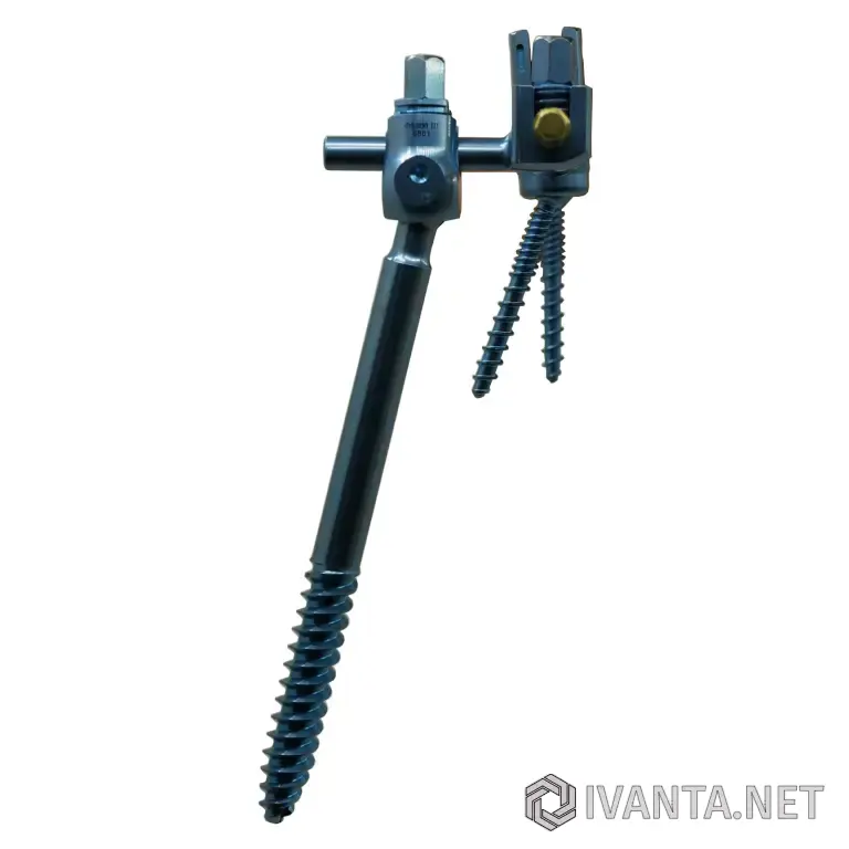 Крестцово-подвздошный педикулярный винт 2