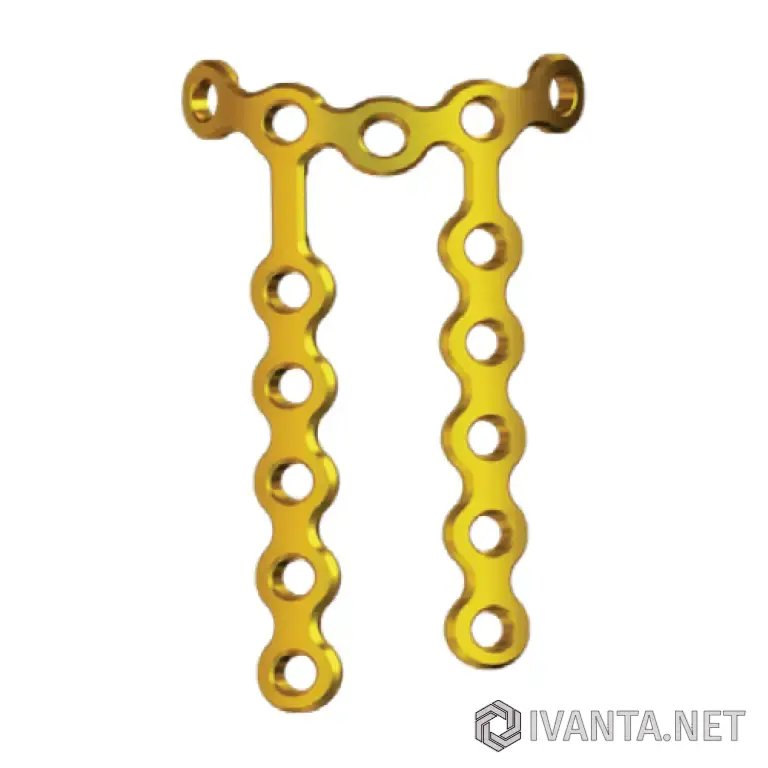 2.0мм Блокированная п-пластина для головки лучевой кости