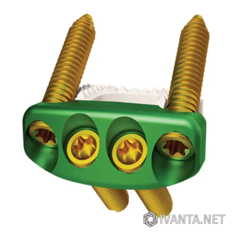 Передний шейный межтеловой кейдж (0-P)