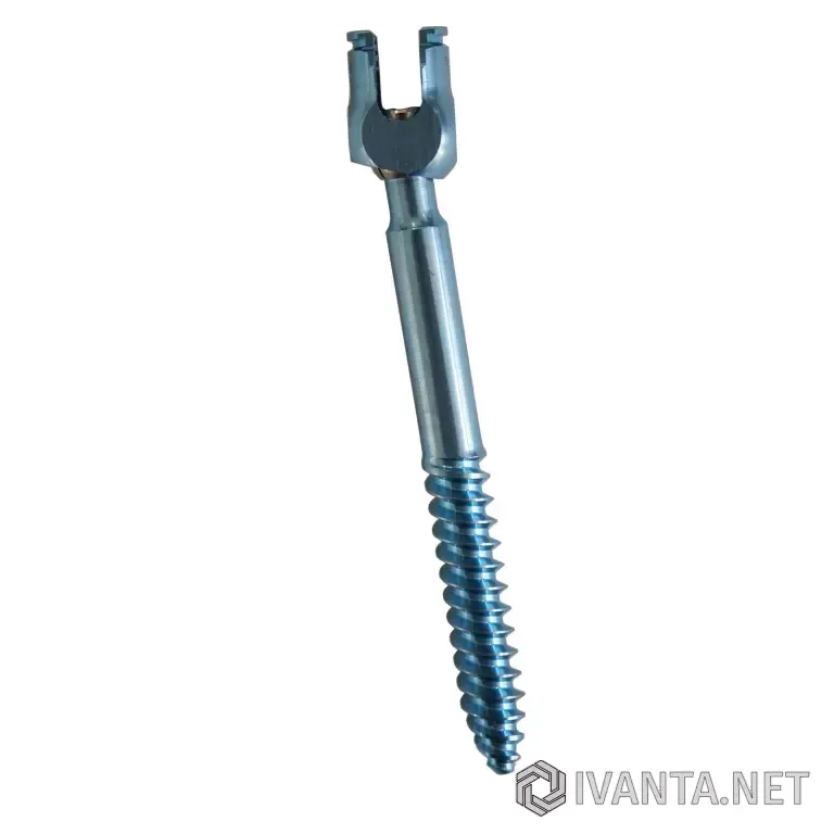 Крестцово-подвздошный педикулярный винт